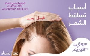 اسباب تساقط -تعرف على أسباب تساقط الشعر الشديد الشعر عند النساء