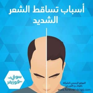 تعرف على أسباب تساقط الشعر الشديد
