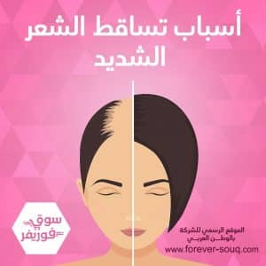 تعرف على أسباب تساقط الشعر الشديد اسباب تساقط الشعر