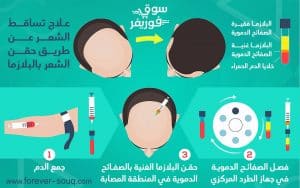 تعرف على أسباب تساقط الشعر الشديد علاج تساقط الشعر بالبلازما