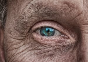 facial wrinkles1